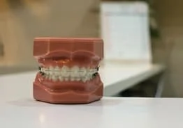 Orthodontics - Ann Arbor, MI Dentist | Ann Arbor Family Dental