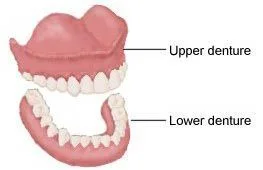 Removable Partial and Complete Dentures Cedar Rapids