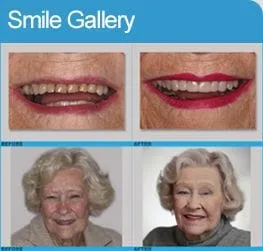 Smile Gallery 