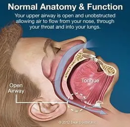 illustration showing man's head and open airway in throat, Washington, DC sleep apnea treatment