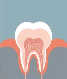Root Canals | Dental Implants in Royal Oak, MI | Douglas Eades, D.D.S.