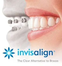 Invisalign logo with two mouths in background, one wearing braces on teeth, other mouth with clear aligners in, Invisalign Miramar, FL dentist