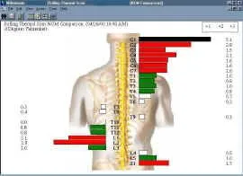 insightThermal3.jpg