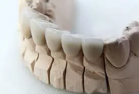 Tooth mold