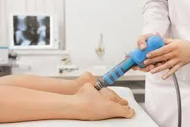 Shockwave Therapy for plantar fasciitis