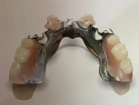 Dentures in Reston, VA