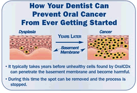 infographic about how your dentist can prevent oral cancer, Mahwah dentist