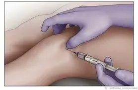 Doctor Giving Knee Injection