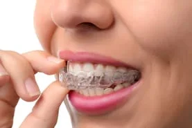 close up of women's mouth, hand holding clear aligners Invisalign Glen Allen, VA Dentist