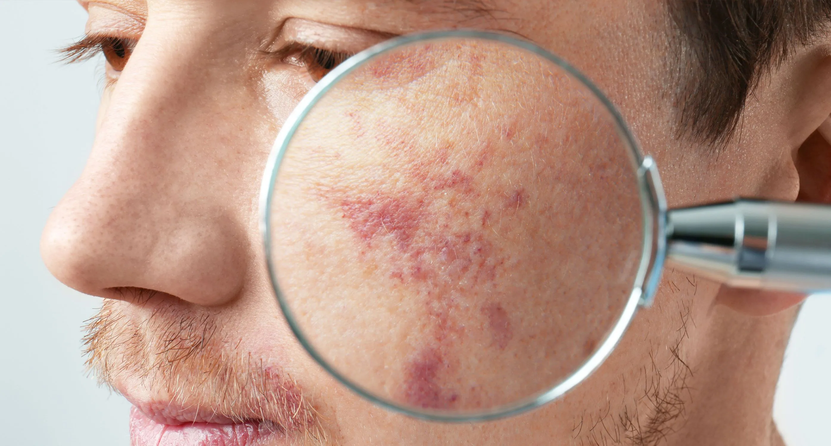 woman with mole on back of neck