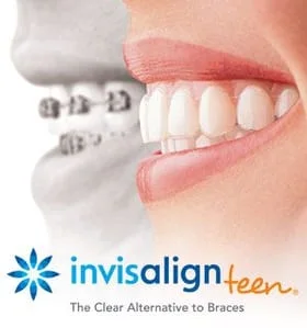 mouth with braces next to mouth wearing clear aligners. logo for Invisalign, Fairfax, VA and South Riding, VA