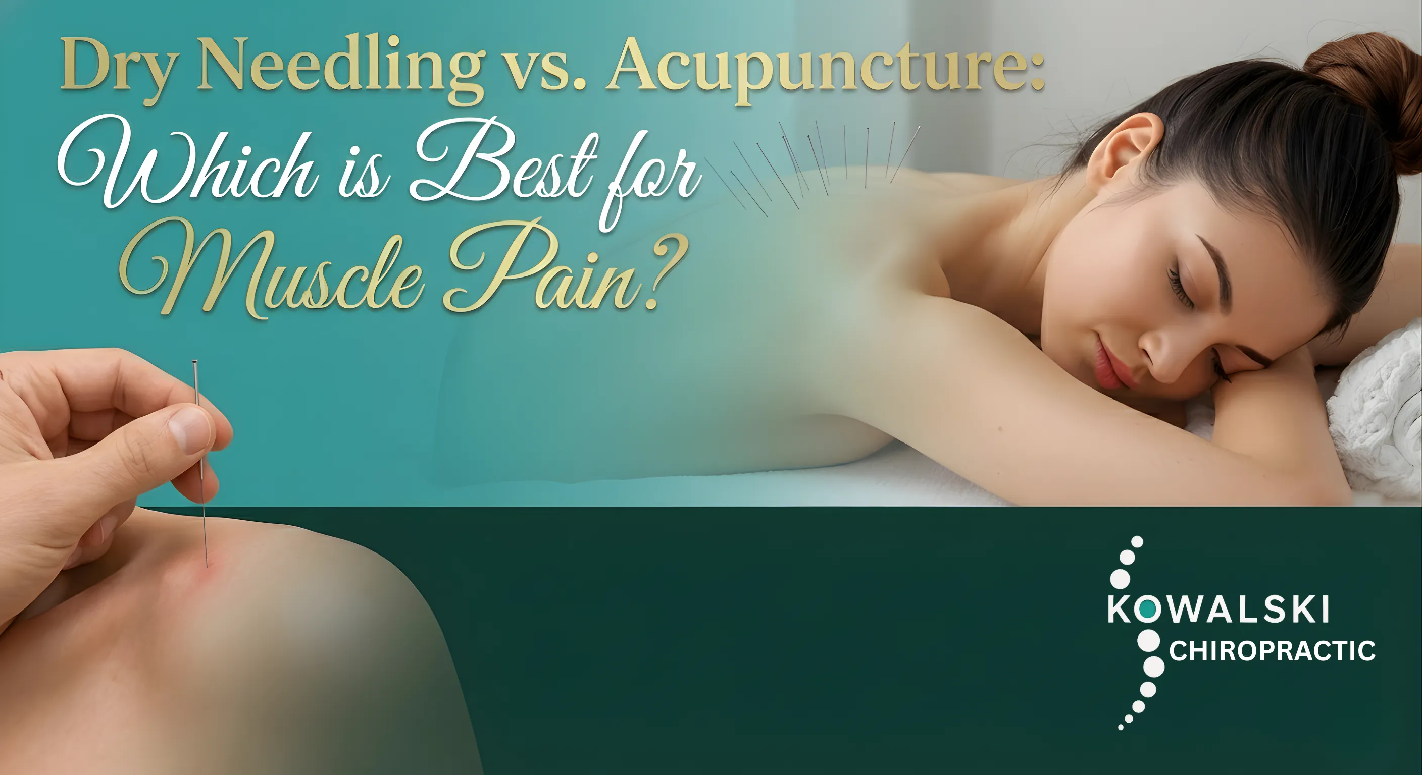 Dry Needling vs. Acupuncture