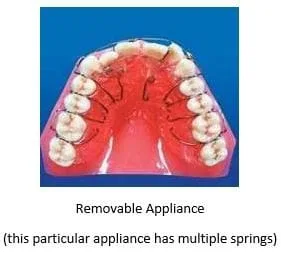 stony_brook_orthodontics_removable_appliance