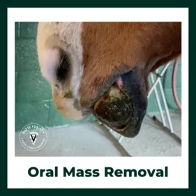 Oral Mass Removal