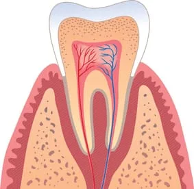 illustration of tooth in gum showing interior of tooth with pulp and nerves, root canal treatment Brookline, MA