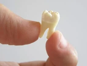 close up of person's thumb and index finger holding extracted molar tooth, tooth extractions Albuquerque, NM periodontist
