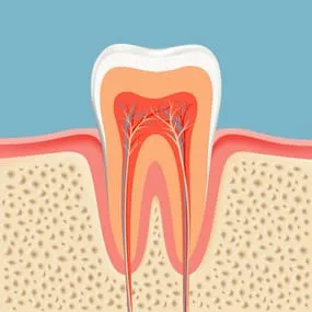illustration of tooth interior and gum tissue, showing nerves and root canals Somerville, MA