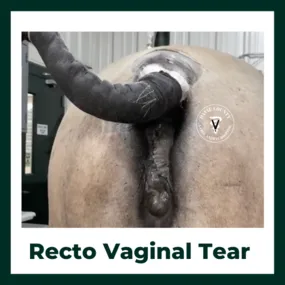 Recto Vaginal Tear Surgery