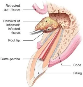 Dental Surgery |Dentist In Washington, DC | DC Endodontics