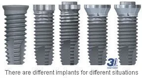 3i different implants