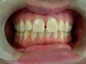 Hartej S. Sood, DDS