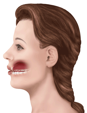 N-stretch-tmj-muscle-pain.gif