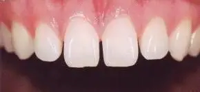 Hartej S. Sood, DDS