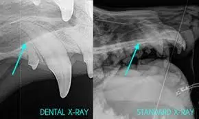 xray