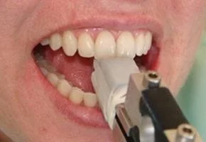 Bite Analysisand TMJ Treatment