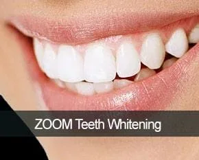 zoom whitening