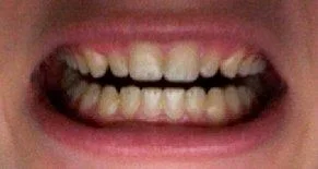 Brooklyn Dentist | Brooklyn dental ZOOM! |  NY