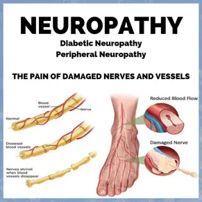 Thoracic Nerve Compression Harris County, TX