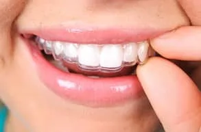 hand holding clear aligners in mouth, Invisalign Fairfax, VA