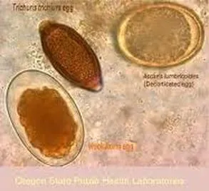 parasite in stool sample