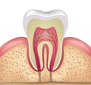 root canal | Dentist in Greenwood, IN | Center Grove Family Dentistry