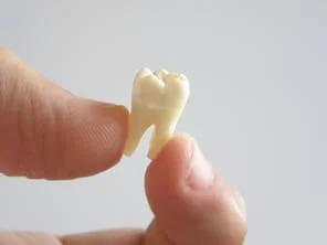 close up of thumb and index fingers holding extracted tooth by roots. Tooth extractions Millbrae, CA dentist