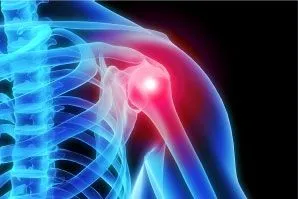 Shoulder Popping, No Pain – A Symptom Of Something Worse Or A Benign  Condition? - Cellaxys