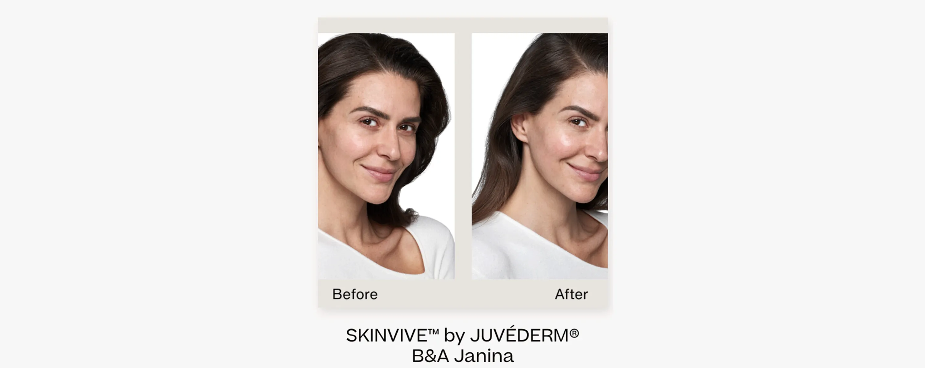 skinvive