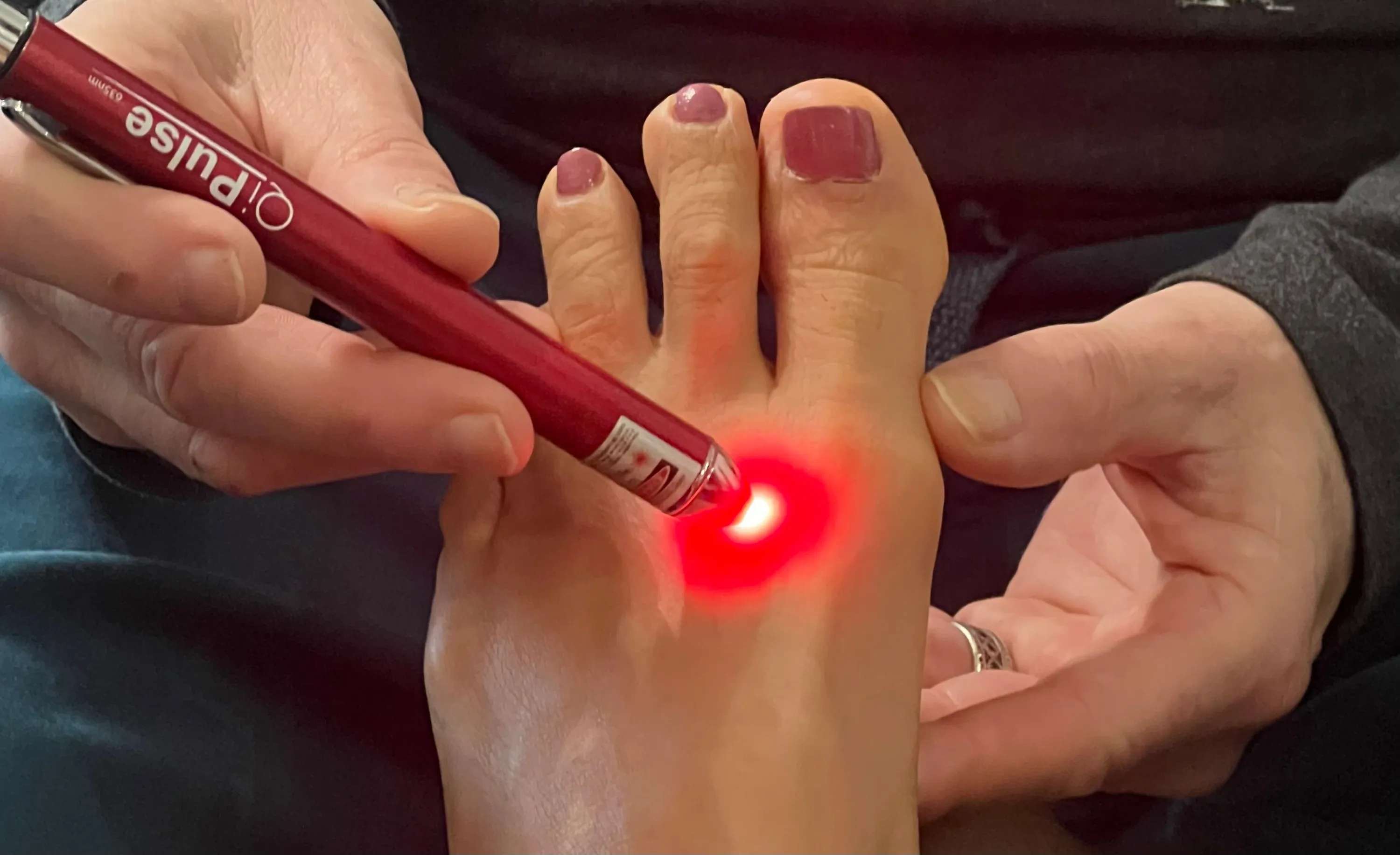 acupuncturelaserclose