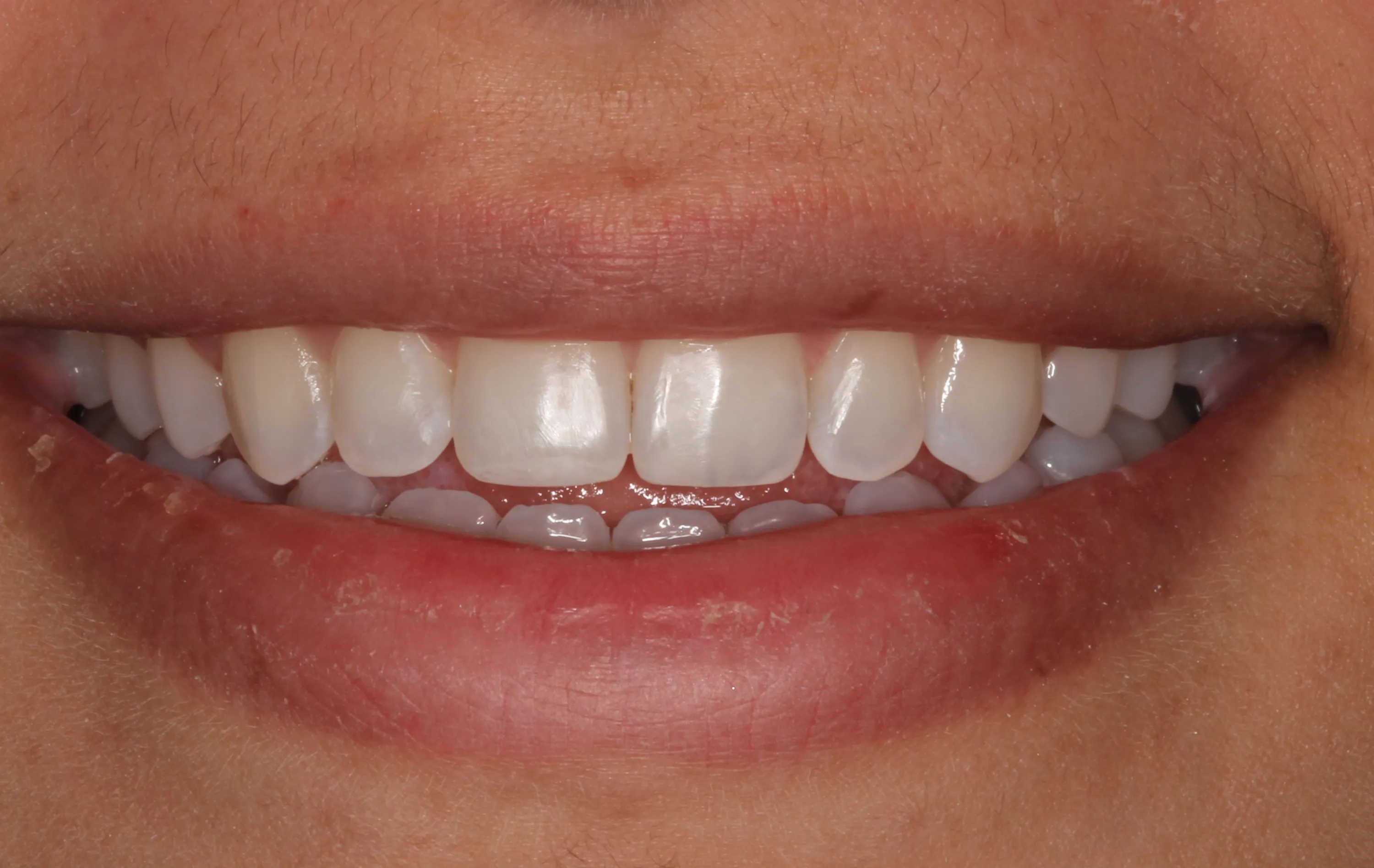 Timeless Smile | Smile Gallery in North Austin