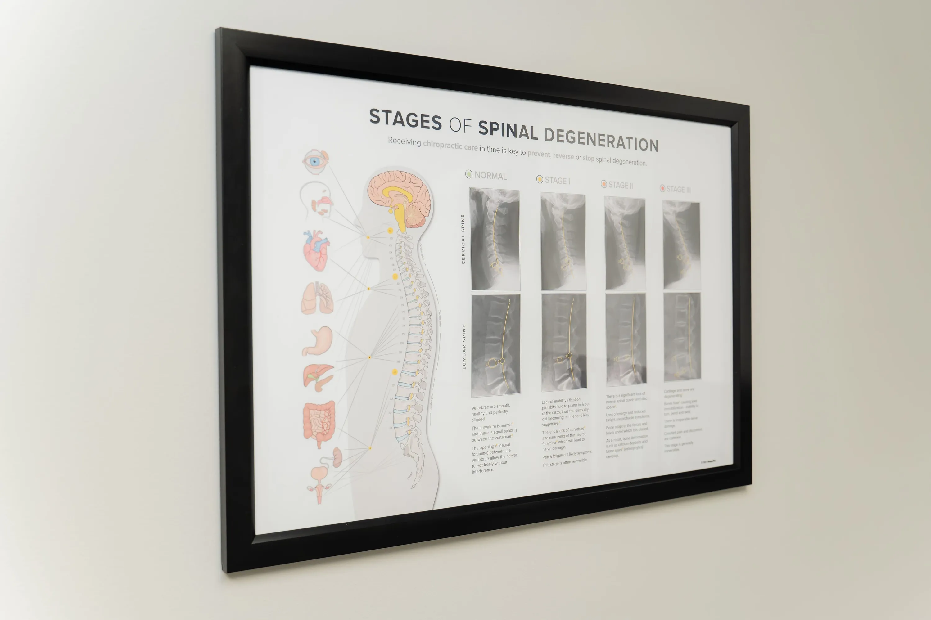 Chiropractor in Pembroke Pines, FL | Gonstead Chiropractic