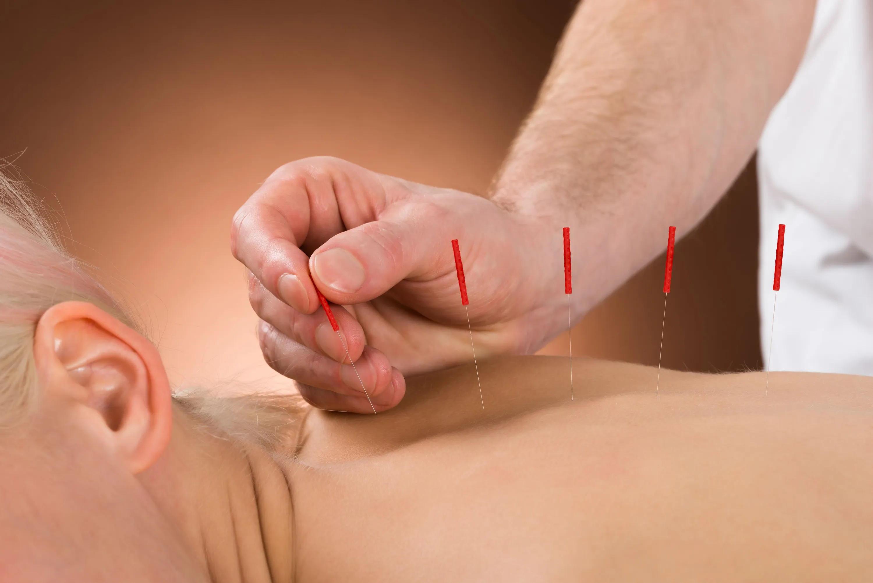 Acupuncturist in New York, Brooklyn, and Staten Island