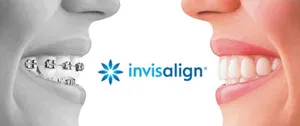 Invisalign