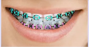 Sudbury orthodontic treatment