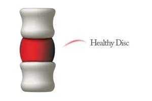 healthy disc