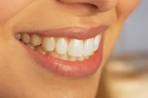 cosmetic-dentistry