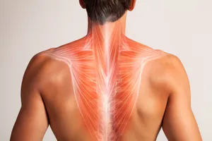 Problems in the Back Muscles | Basalt, Aspen, Carbondale, Spine Spot Chiropractic