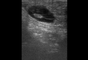 Equine early stage pregnancy