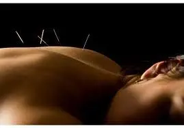 needling