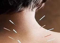 Dry Needling